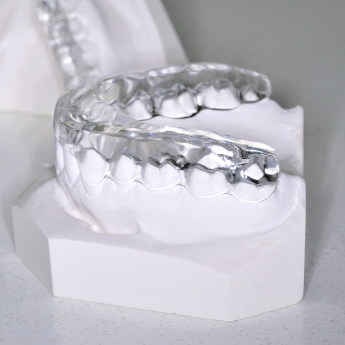 Occlusal Splint